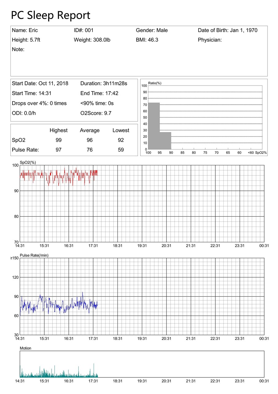 Bild von Checkme O2 - PC-Auswertungssoftware + Datenkabel