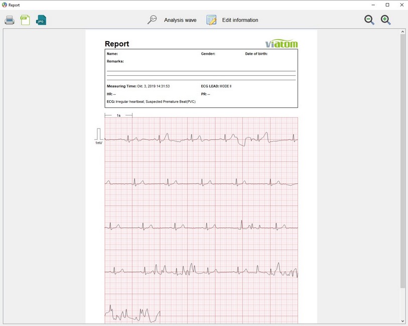 Picture of Heartmate - PC-Reporting Software