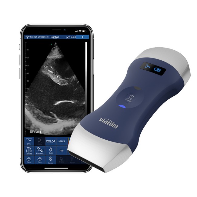 Picture of Viatom Dual-Head Wireless Portable Doppler Ultrasound (Modell 2025)