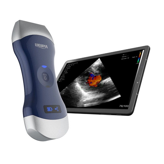 Picture for category Sonography/ultrasound devices