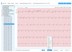 EKG-Report-Viatom TH12