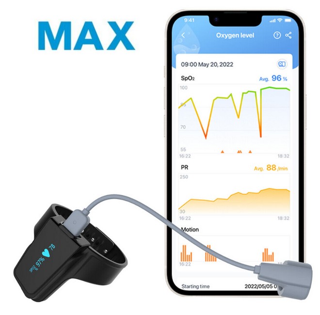 Checkme O2 Max Pulsoximeter