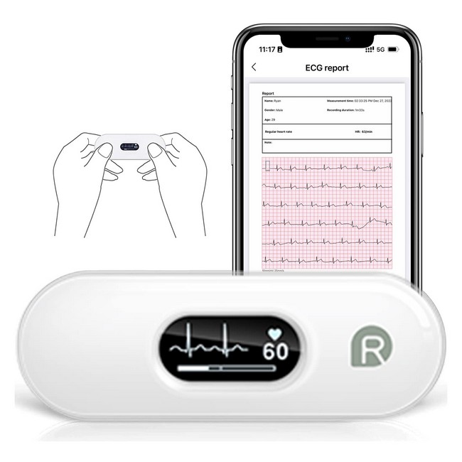 Bild von Checkme DuoEK S Mobiler EKG Monitor