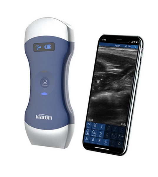 Bild von Portables HighEnd Ultraschallgerät Viatom Dual-Head Wireless (Modell 2025)