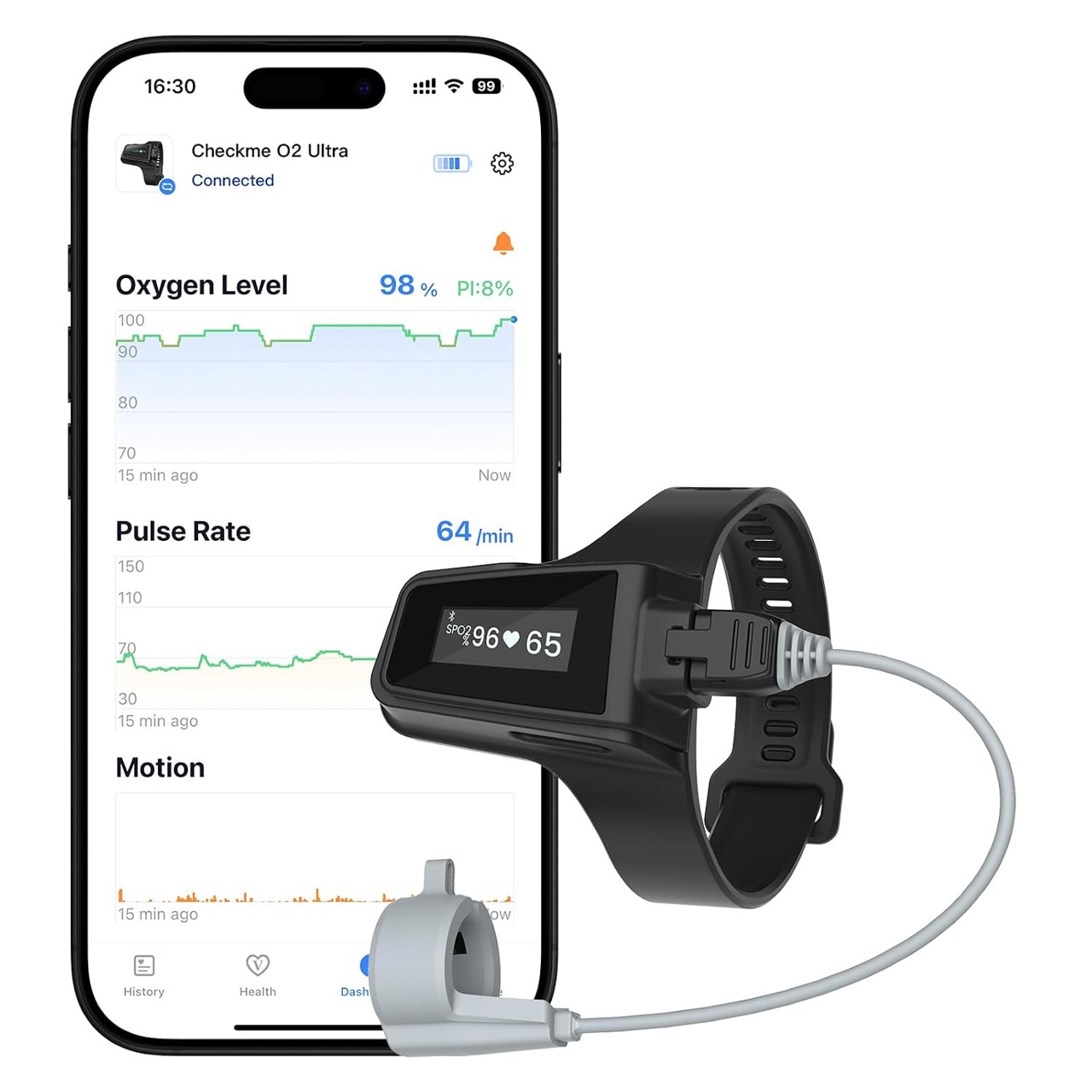 Viatom Wellue Checkme O2 Ultra Pulsoximeter